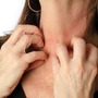 Kobietę swędzi szyja skóry