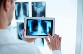 Zdjęcie płuc z badania tomografem