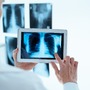 Zdjęcie płuc z badania tomografem