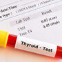Próbka krwi do badania poziomu PTH