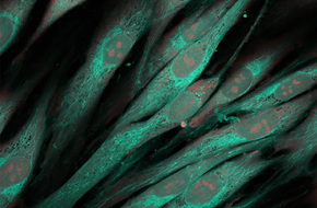 Komórki fibroblasty pod mikroskopem