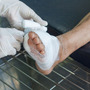 Bandażowanie stopy z powodu neuropatia cukrzycowej