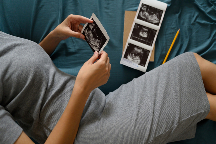 Kobieta w 18 tygodniu ciąży przegląda zdjęcia płodu z USG