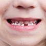 Dziecko zgrzytające zębami mlecznymi