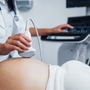 Kobieta mająca łożysko przodujące w ciąży podczas badania USG