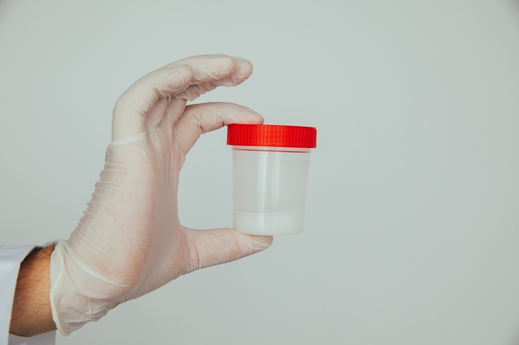 Dłoń w rękawiczce medycznej trzymająca pojemnik ze spermą i czerwoną zakrętką