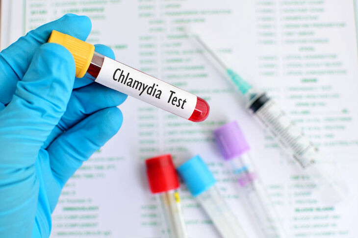 Diagnostyka chlamydii
