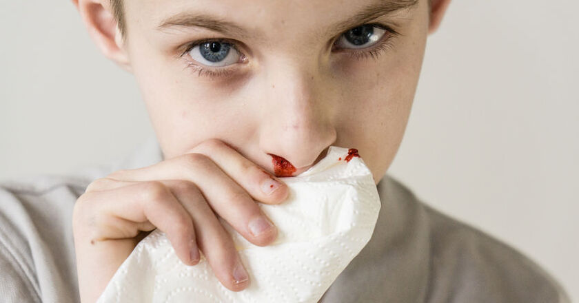 Krwawienie Z Nosa Przyczyny Jak Zatamowac Krwawienia Z Nosa