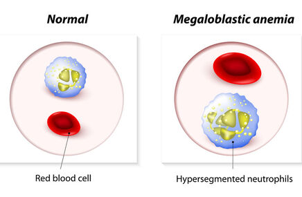 Hemoglobina, czyli czerwony barwnik krwi