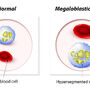 Hemoglobina, czyli czerwony barwnik krwi