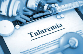Diagnostyka tularemii