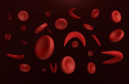 Płytki krwi w morfologii PDW