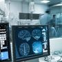 Mózg człowieka wyświetlony na ekranie monitora