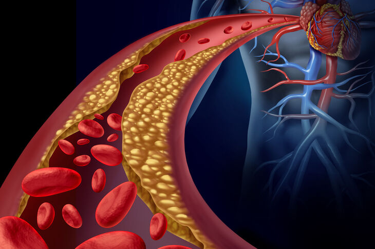 Badanie poziomu cholesterolu we krwi
