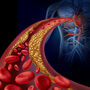 Badanie poziomu cholesterolu we krwi