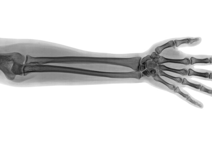 Szkielet człowika z zaznaczoną kością przedramienia