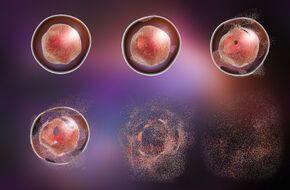 Śmierć komórki w organizmie wielokomórkowym