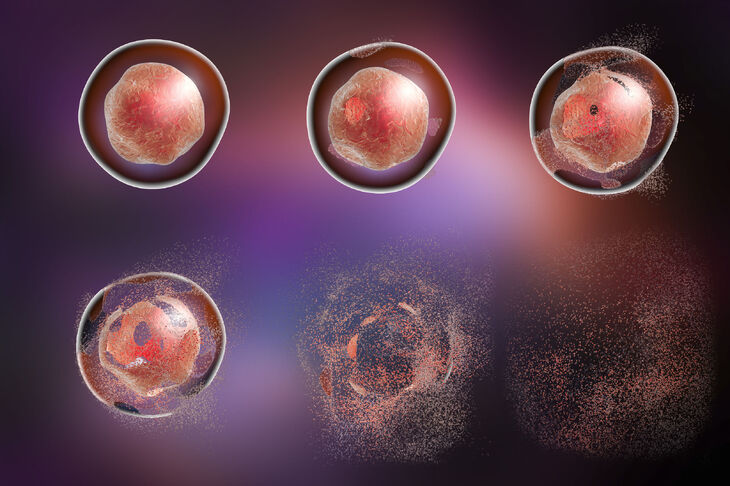 Śmierć komórki w organizmie wielokomórkowym