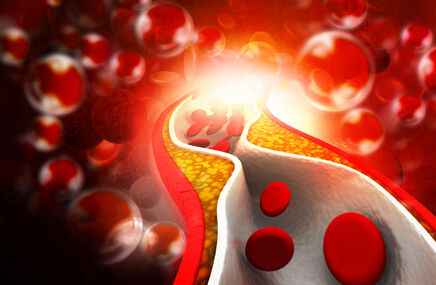 Wysoki cholesterol blokujący przepływ krwi