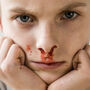 Chłopiec z krwotokiem z nosa