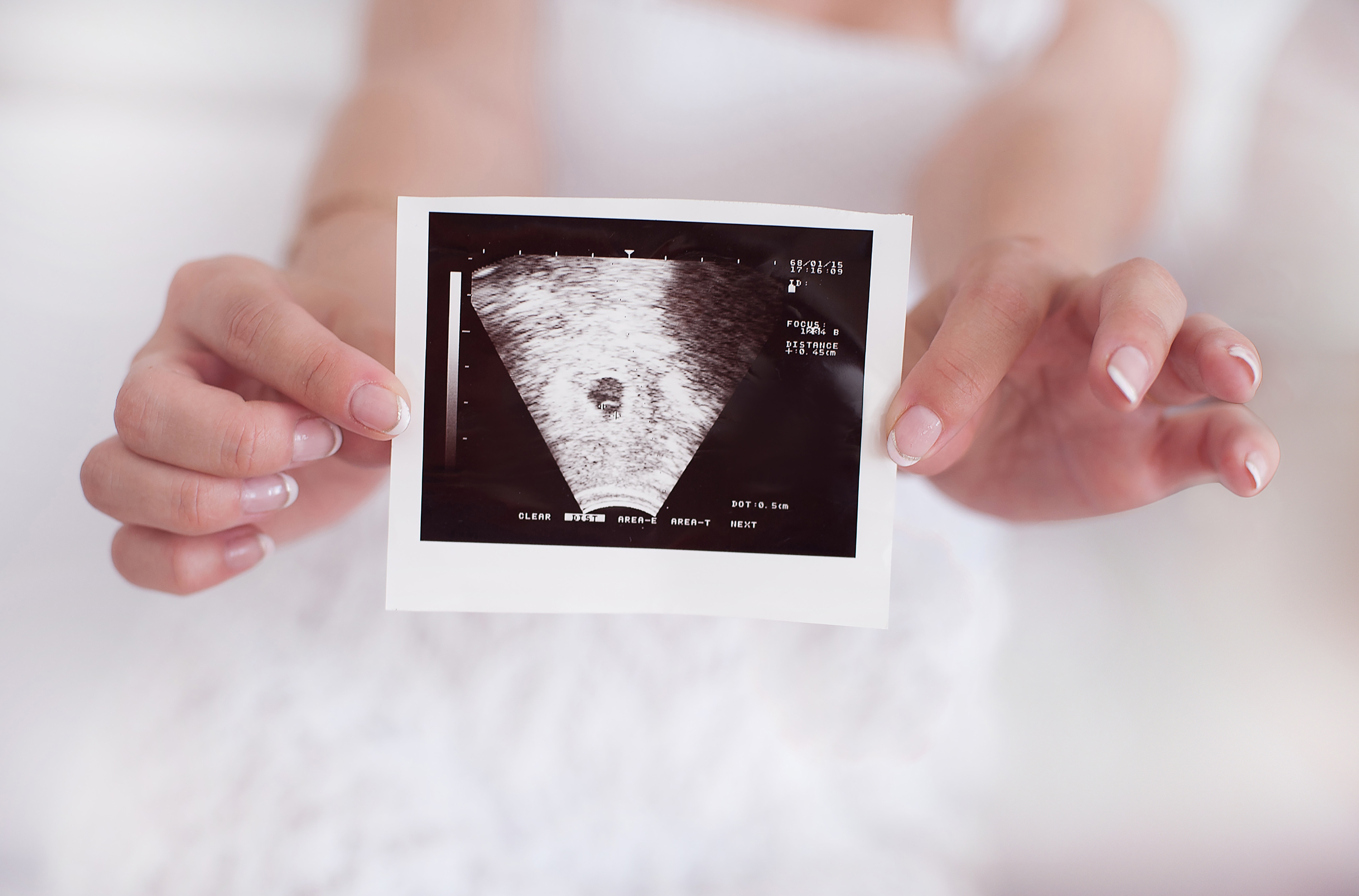 После первого узи. Снимок УЗИ на беременность 1 ребенок. Снимок УЗИ первый скрининг. 1 Триместр беременности снимки УЗИ.