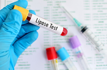 Próbka do badania poziomu lipazy