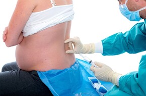 Kobieta w ciąży podczas przyjmowania znieczulenia zewnątrzoponowego