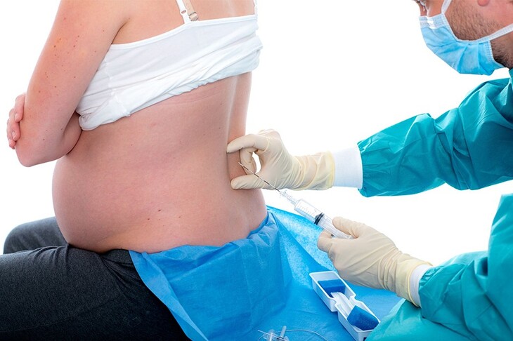 Kobieta w ciąży podczas przyjmowania znieczulenia zewnątrzoponowego