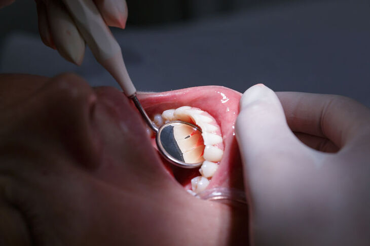 Pacjent cierpiący na zapalenie zębów