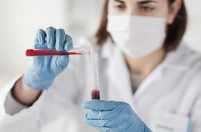 Próbki krwi w laboratorium