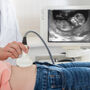 Wizyta w ciąży u ginekologa